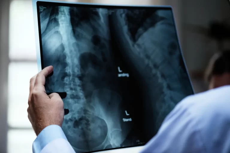 Curso Técnico em Radiologia: O que se aprende, onde fazer o curso no RJ e mais